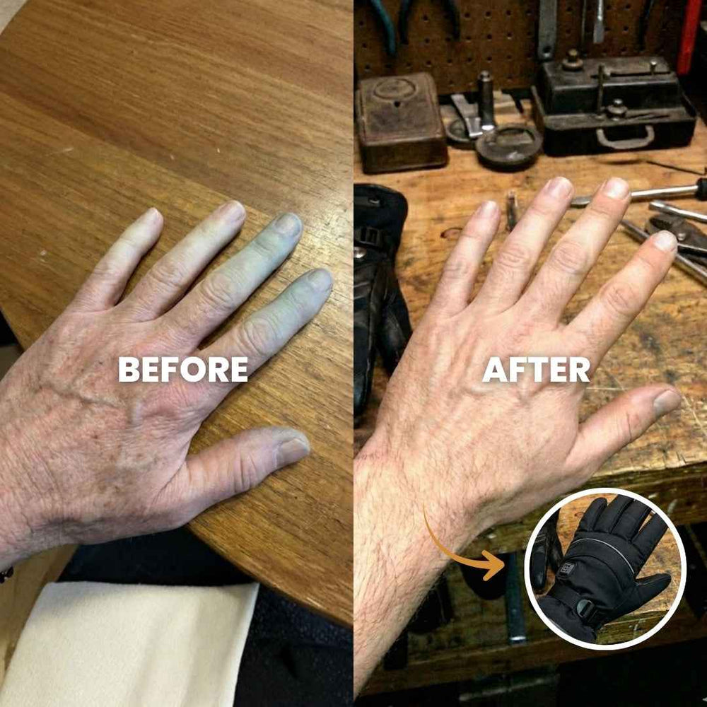 Do your fingers go numb when you step outside?