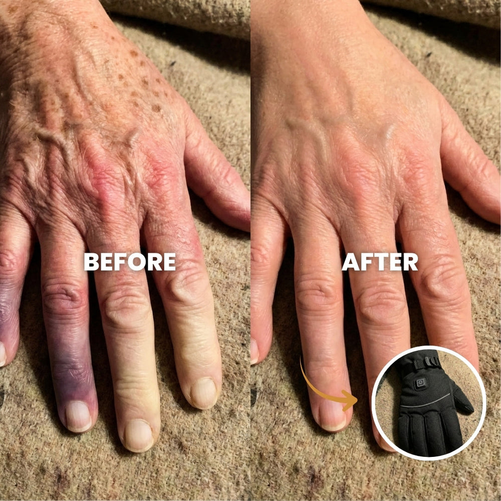 Do your fingers go numb when you step outside?
