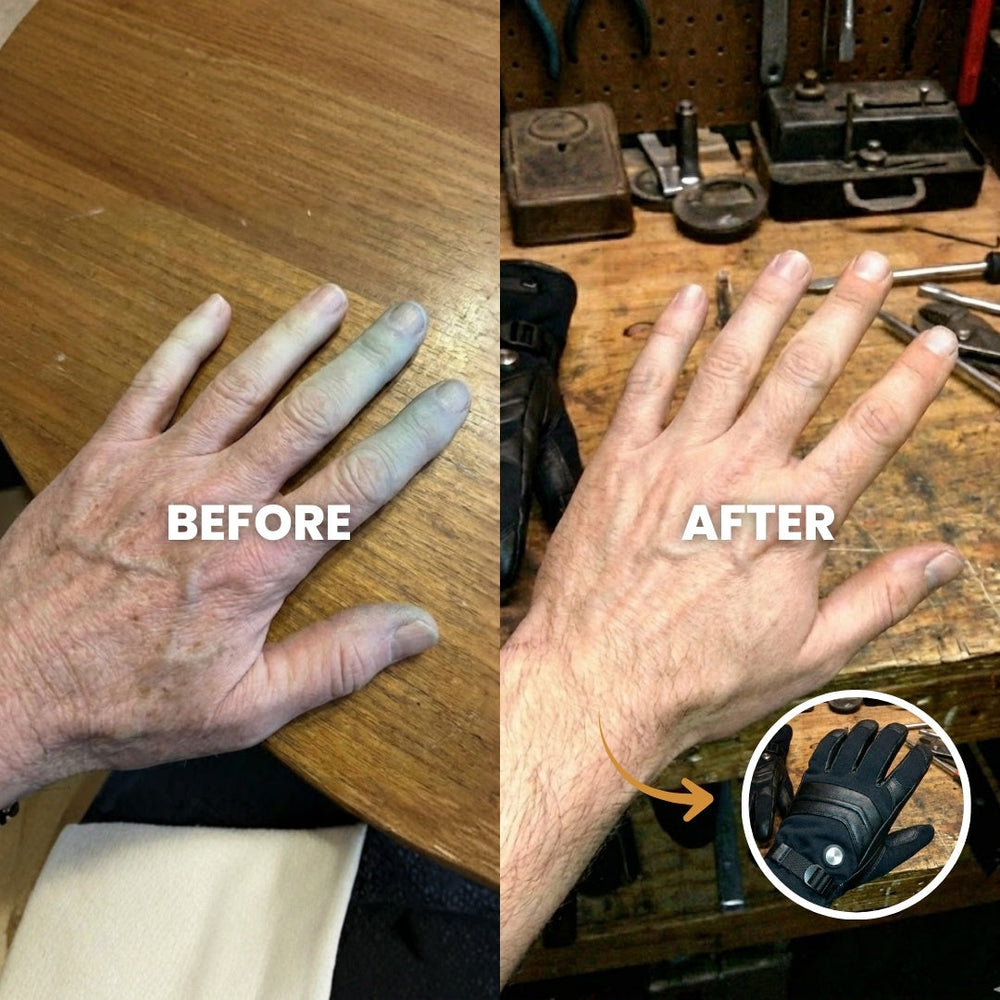 Do your fingers go numb when you step outside?